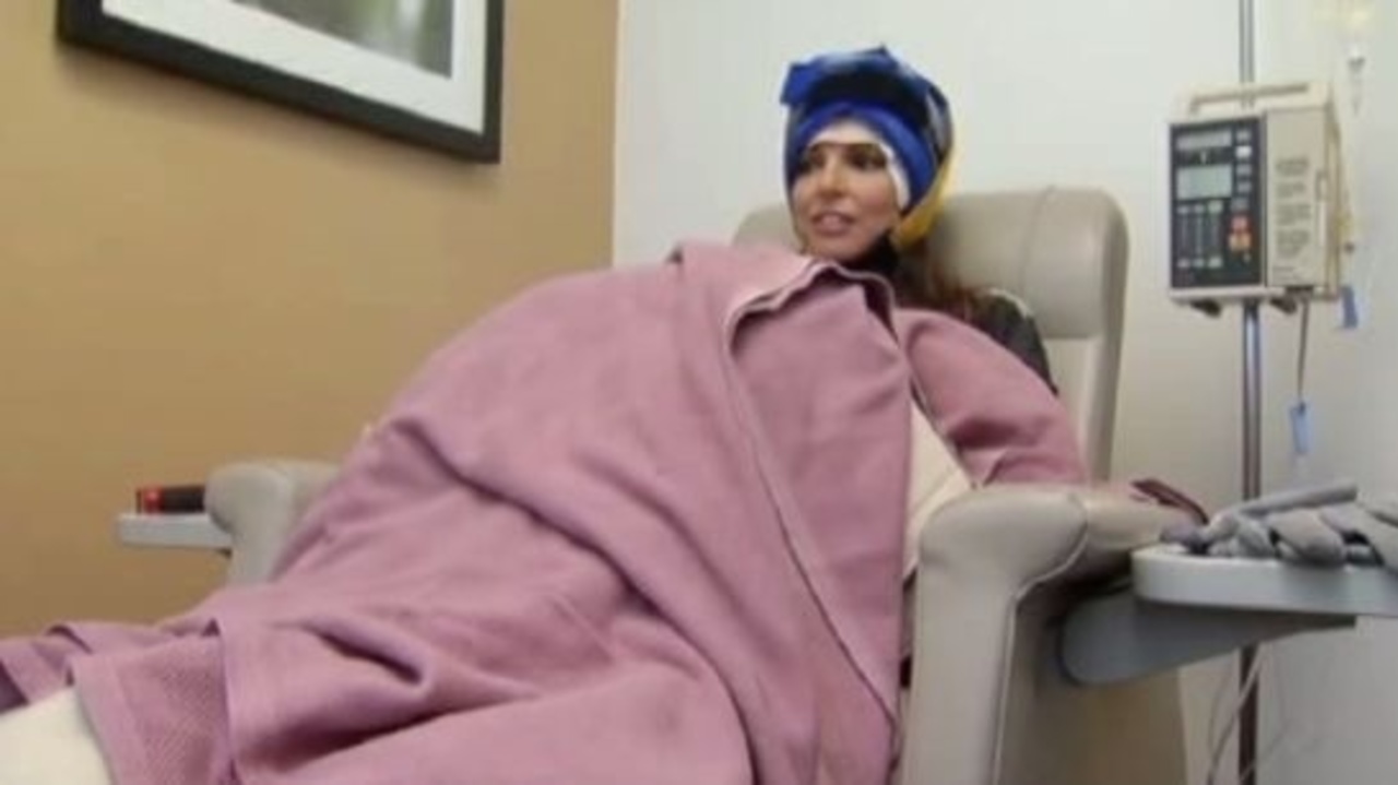 Cold cap therapy allows chemotherapy 
